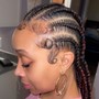 Loc Coils