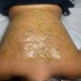 Brazilian Wax