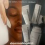 Microdermabrasion