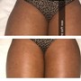 Brazilian Wax