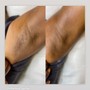 Men’s Brazilian Wax