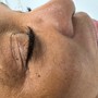 Eyelash Extension Removal