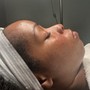 Microdermabrasion Facial + LED Therapy