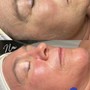 Dermaplaning  facial