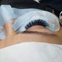 Eyelash Extension Removal