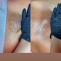 Underarm Wax