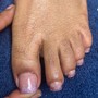 Toe nail restoration