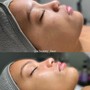 Facial