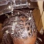 Scalp Treatment