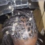 Scalp Treatment