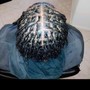 Scalp Treatment