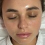 Dermaplaning Facial