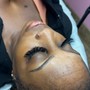 Radio Frequency Facial/Face Lift