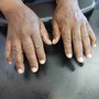 Callus Removal