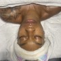 High Frequency Facial