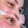 Eyelash Extension Removal