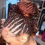 Loc Coils