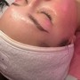 Hydrating facial