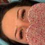 Eyelash Extension Removal