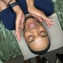 Dermaplane facial