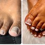 Acrylic Toe Nails