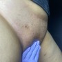 Brazilian Wax