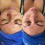 Eyelash Extension Removal