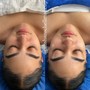 Eyelash Extension Removal