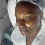 Chemical peel