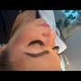 Lash Removal