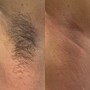 Underarm Wax