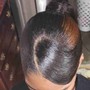 Scalp Treatment