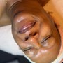 Enzyme Facial