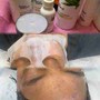 Diamond Microdermabrasion Facial