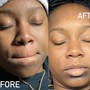 Ultimate Glo Facial