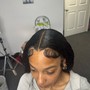 Scalp Treatment