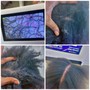 Hair loss Consultaion w/Scalp analysis