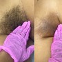 Routine Brazilian Wax