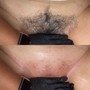 Brazilian Wax