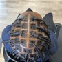 Scalp Treatment