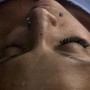 Eyelash Extension Removal