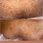 Brazilian Wax