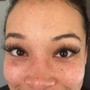 Eyelash Extension Removal