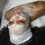 Dermaplaning Facial