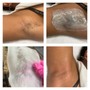 Women’s Underarm Wax