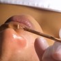 Eyelash Extension Removal