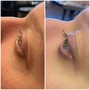 Lash Lift