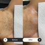 Men’s Brazilian Wax