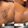 Brazilian Wax