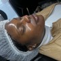 Dermaplaning Facial